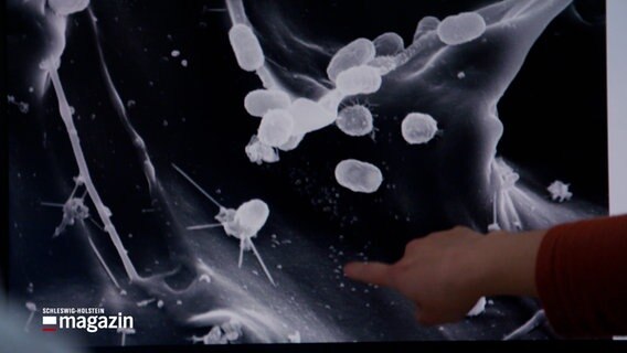 Eine Hand zeigt auf ein Foto von vergrößerten Bakterien. © NDR 
